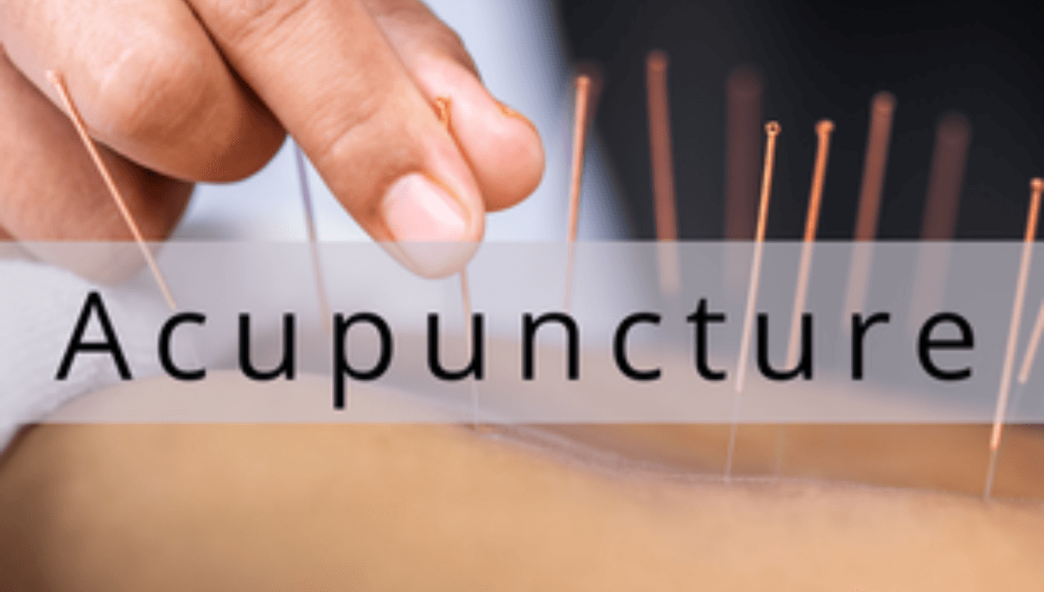 Image for Registered Acupuncture TCM